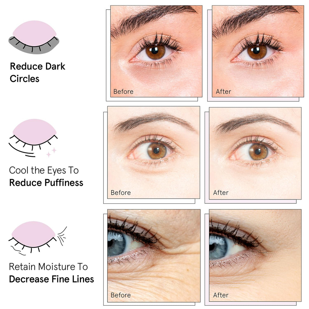 grace & stella Retinol Under Eye Patches for Puffy Eyes and Dark Circles - Restoring Gel Under Eye Masks with Hyaluronic Acid - Vegan Cruelty-Free Skincare, Birthday Gifts for Women (Purple, 24 Pairs)